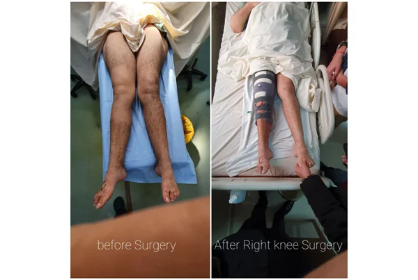 Online Orthopaedic Clinic