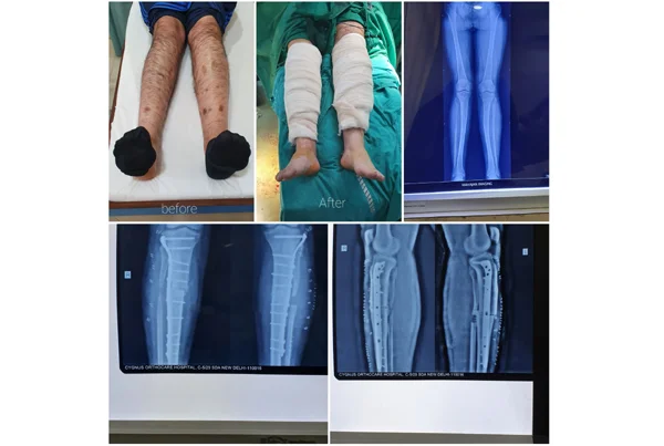 Online Orthopaedic Clinic