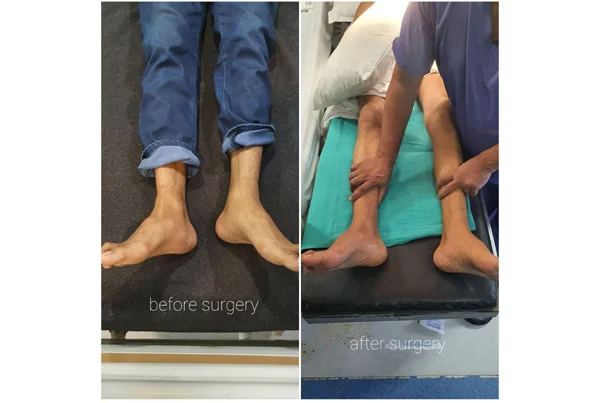 Online Orthopaedic Clinic