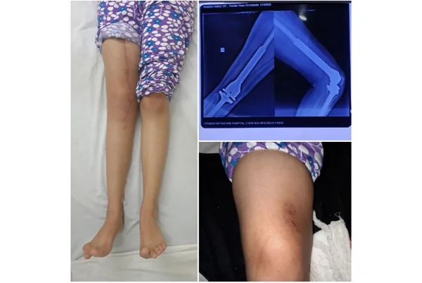 Online Orthopaedic Clinic