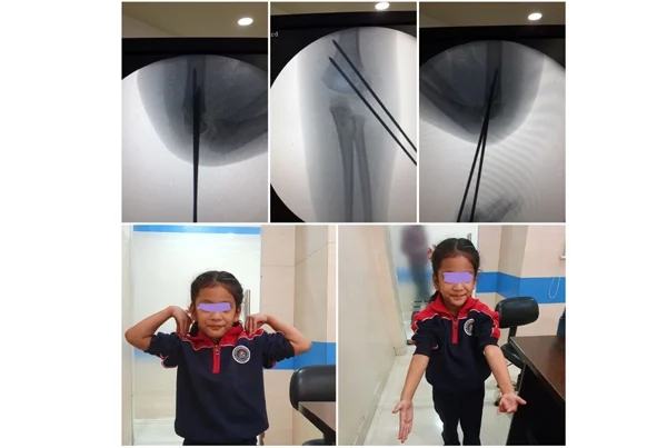 Online Orthopaedic Clinic