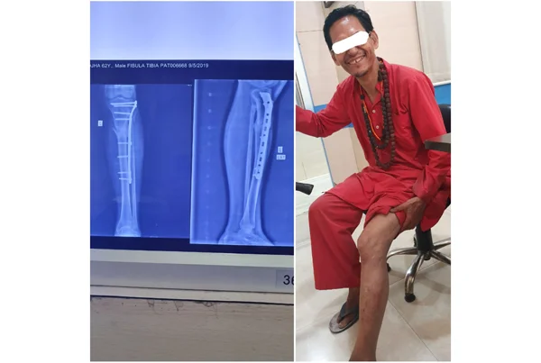Online Orthopaedic Clinic