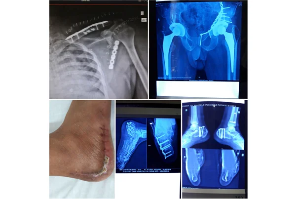 Online Orthopaedic Clinic